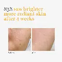 BeforeAfter-min.webp