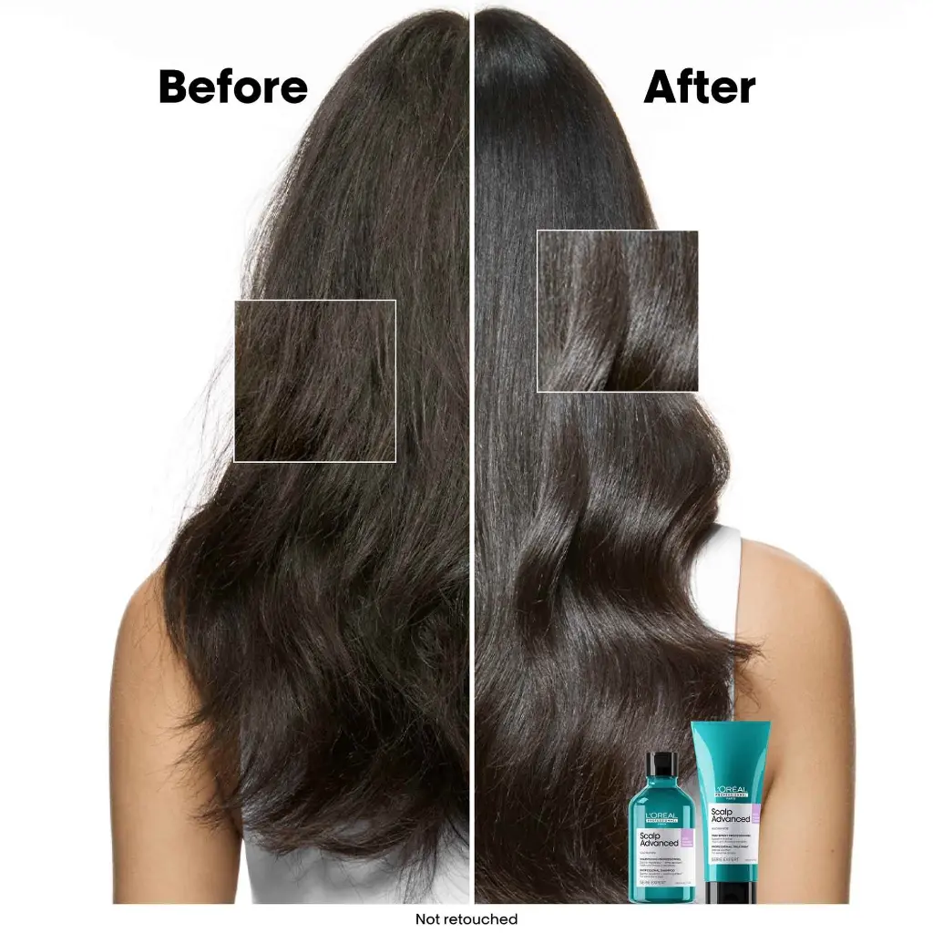 Before-and-after-of-anti-discomfort-shampoo.webp